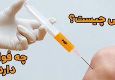 پی آر پی چیست و چه فوایدی دارد؟