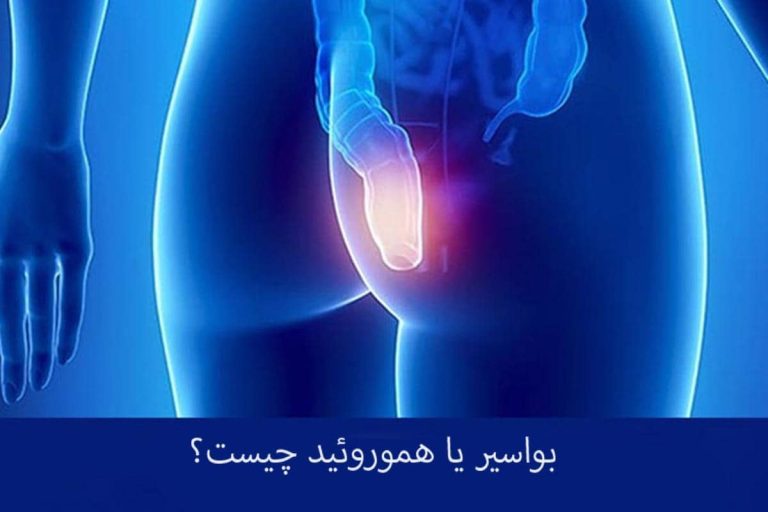 راه های پیشگیری و بهبود هموروئید