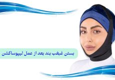 گن غبغب