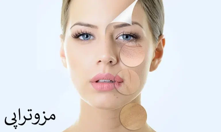 مزوتراپی چیست ؟