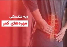 دیه دیسک کمر,دیه شکستگی مهره های کمر