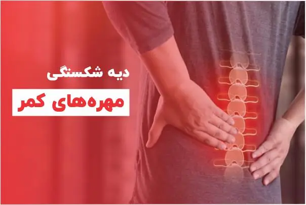 دیه دیسک کمر,دیه شکستگی مهره های کمر