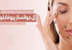 جوانسازی پوست با مزوژل پروفایلو: راهکاری نوین برای بهبود ظاهر و سلامت پوست