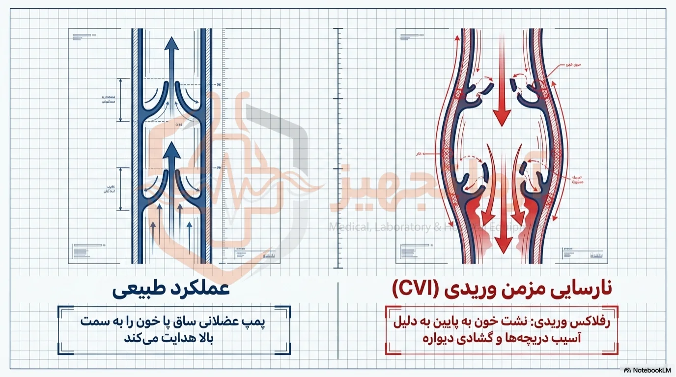 علائم واریس پا