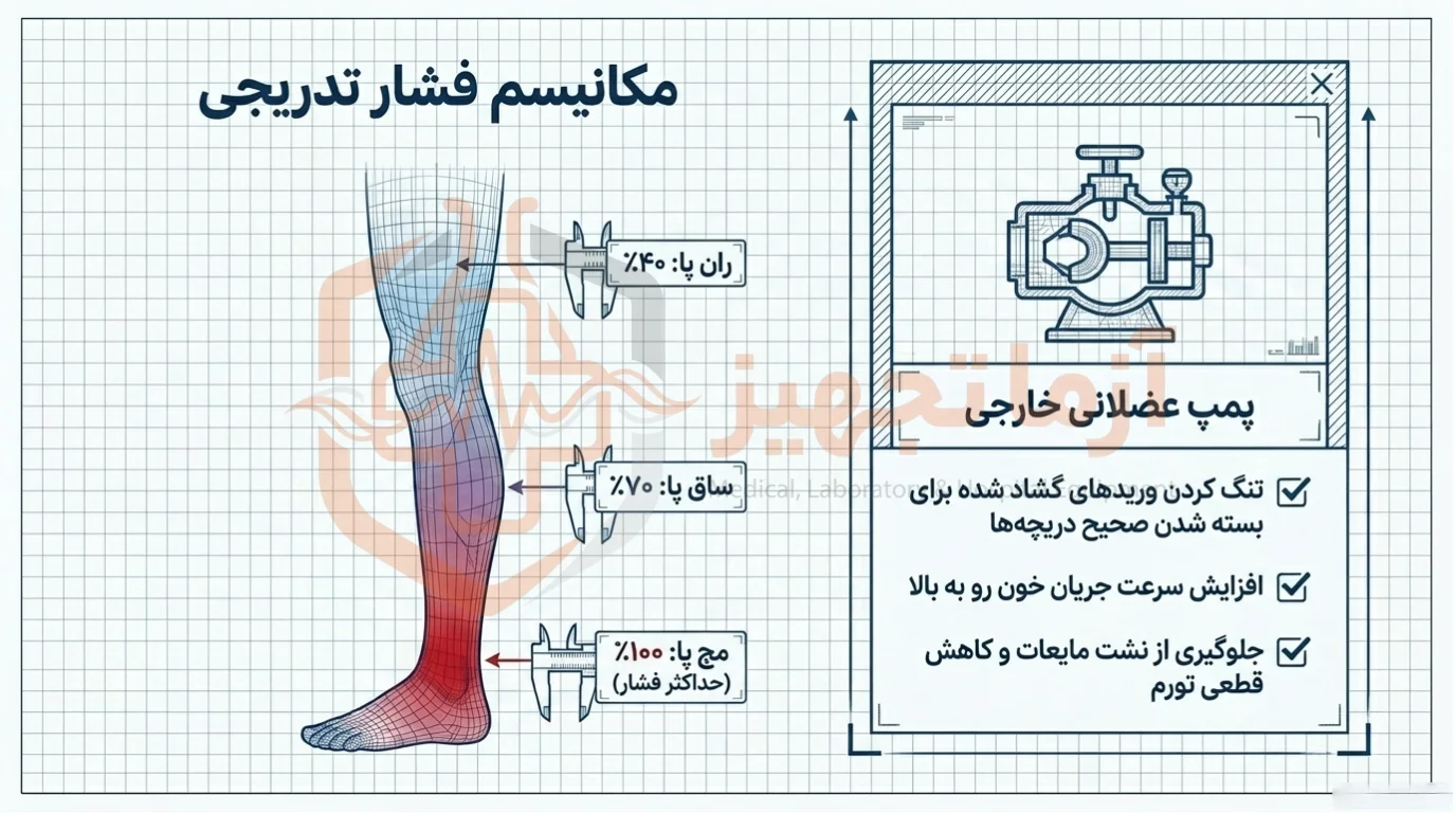 مکانیسم جوراب واریس