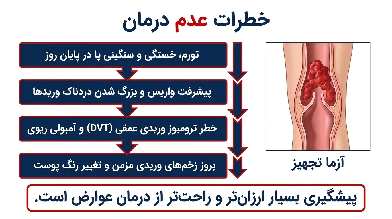 جوراب واریس سیگواریس