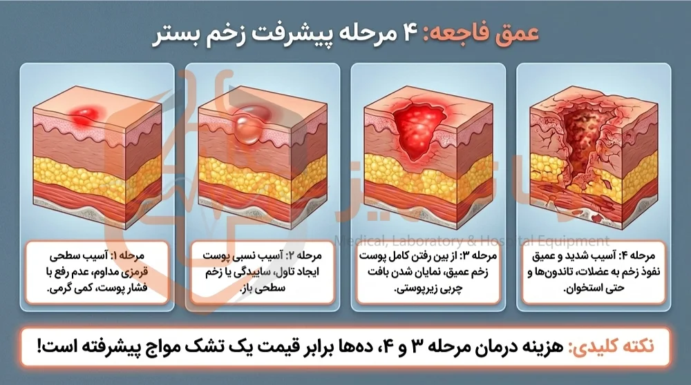 تشک مواج تخم مرغی